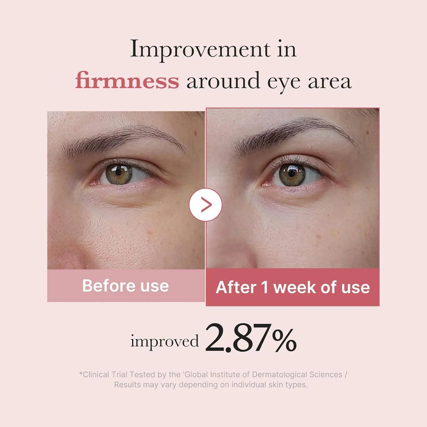 MEDICUBE - PDRN Pink Peptide Eye Cream