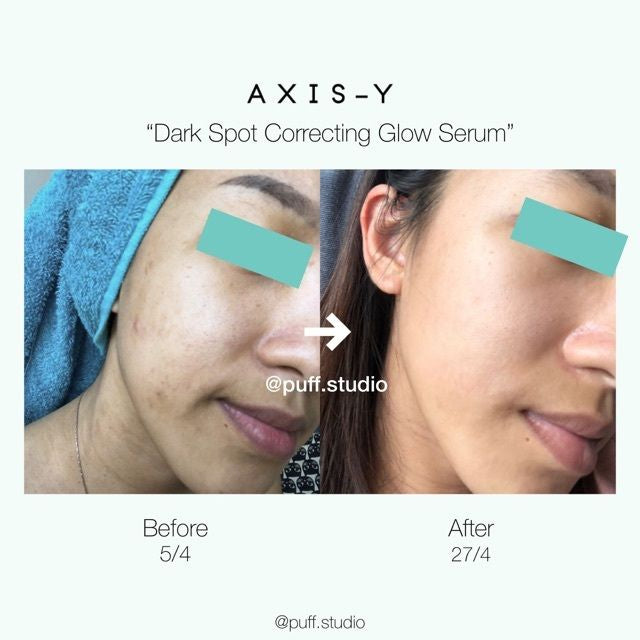 AXYS-Y - Dark Spot Correcting Glow Serum 50ml